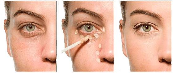 Trvalý make-up na ukrytie modrín pod očami