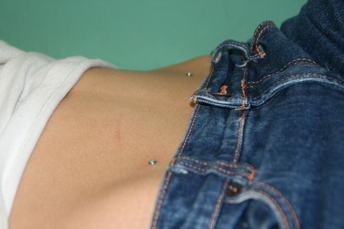 Mikrodermálne piercing: ako sa robia mikrodermabry (foto)