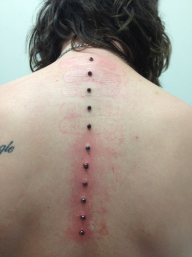 Mikrodermálne piercing: ako sa robia mikrodermabry (foto)